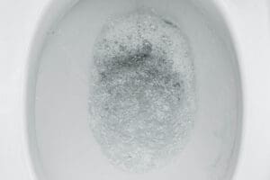 Toilet Making Noise After Flushing? Causes & Fixes | LimRic Plumbing